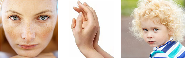 skin-type-1
